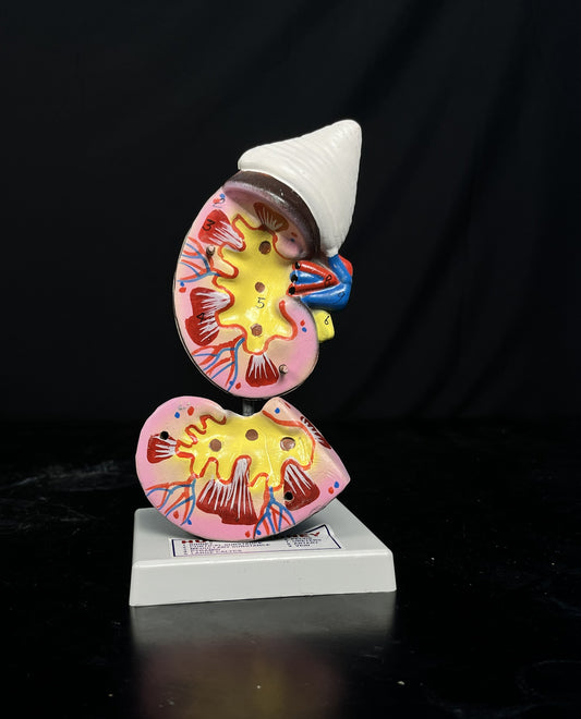 Human Kidney on Stand Model