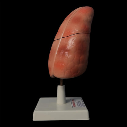 Human Lung On Board