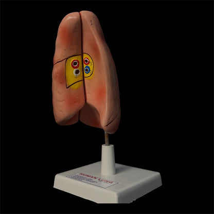 Human Lung On Board